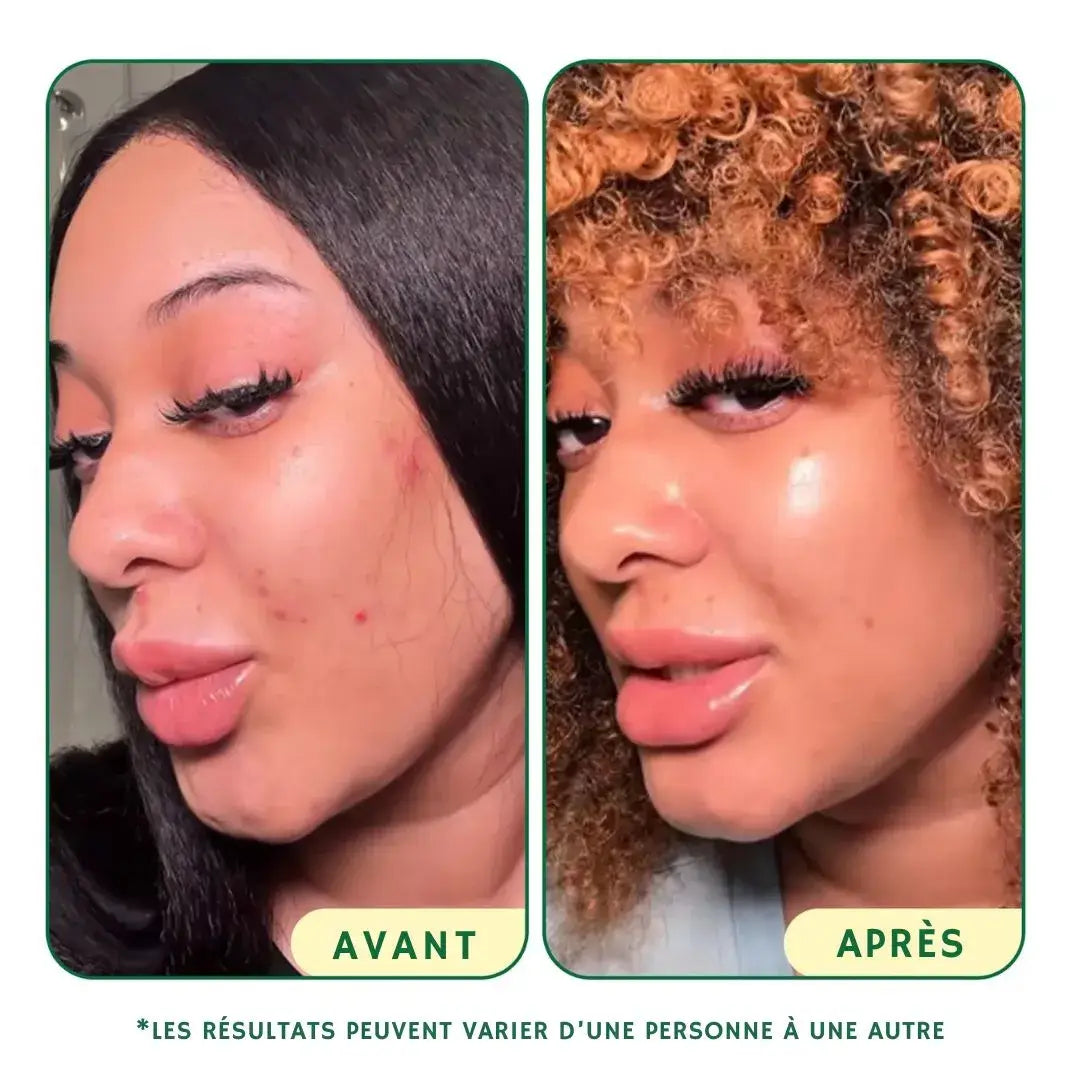 Toner Pads Régénérants & Revitalisants
