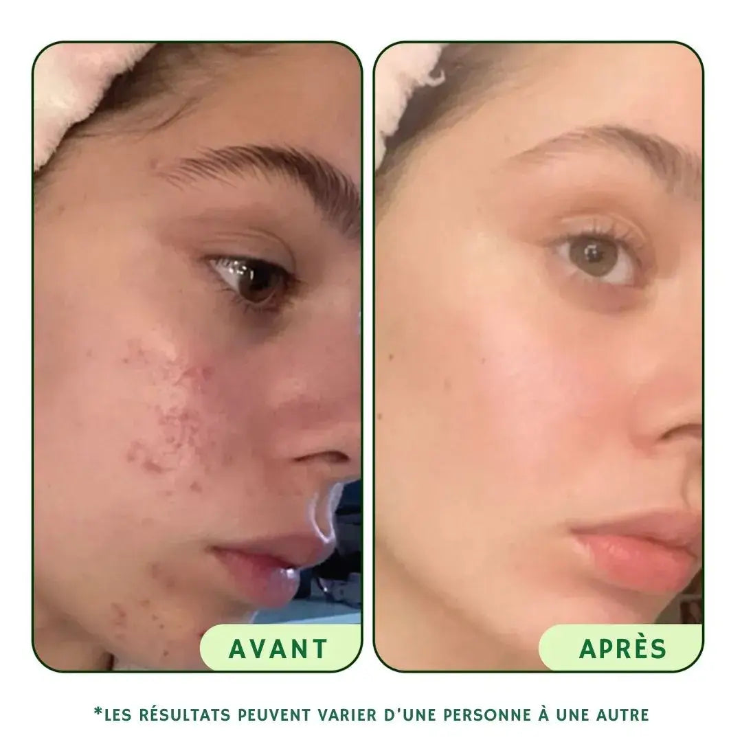 Toner Pads Régénérants & Revitalisants